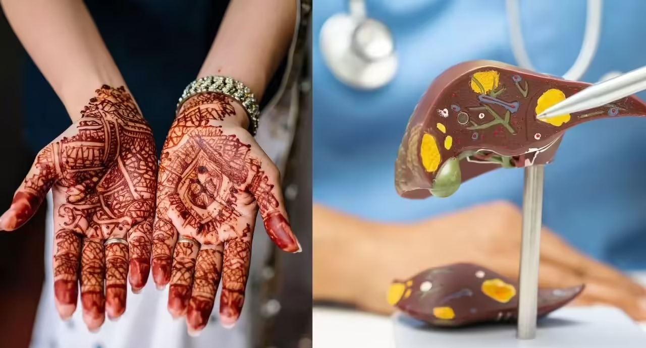 New hope for liver fibrosis patients found in traditional henna pigment